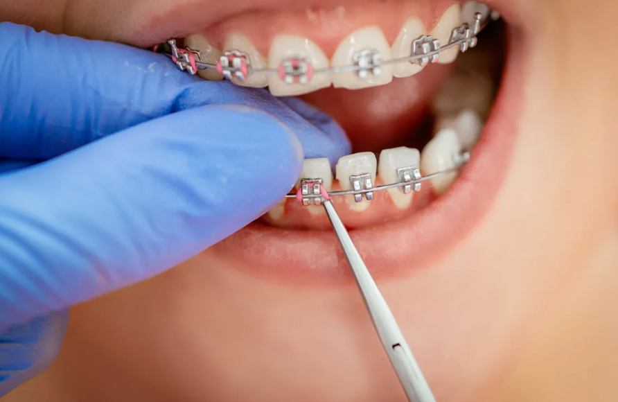 Orthodontist services in Duncan